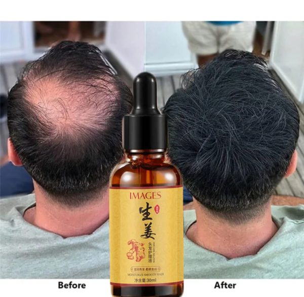 Product Title: Images Hair Growth Serum 30ml