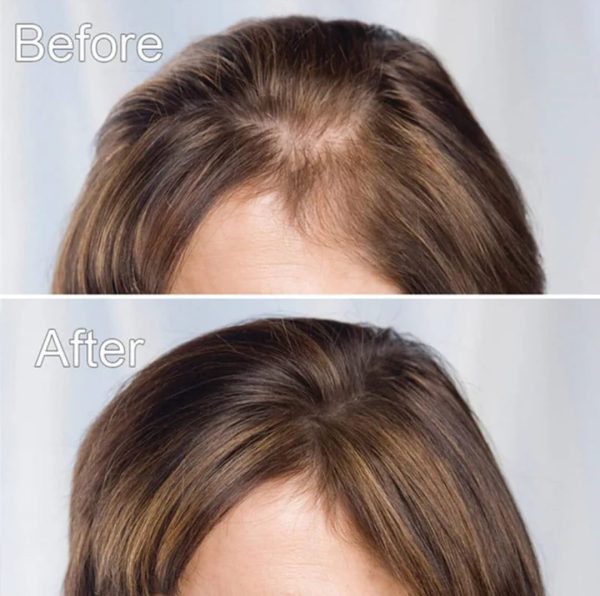 Product Title: Images Hair Growth Serum 30ml