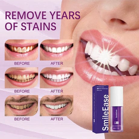 Teeth white Hismiles V34 Colour Corrector Serum – 30ml | Hismile For Teeth
